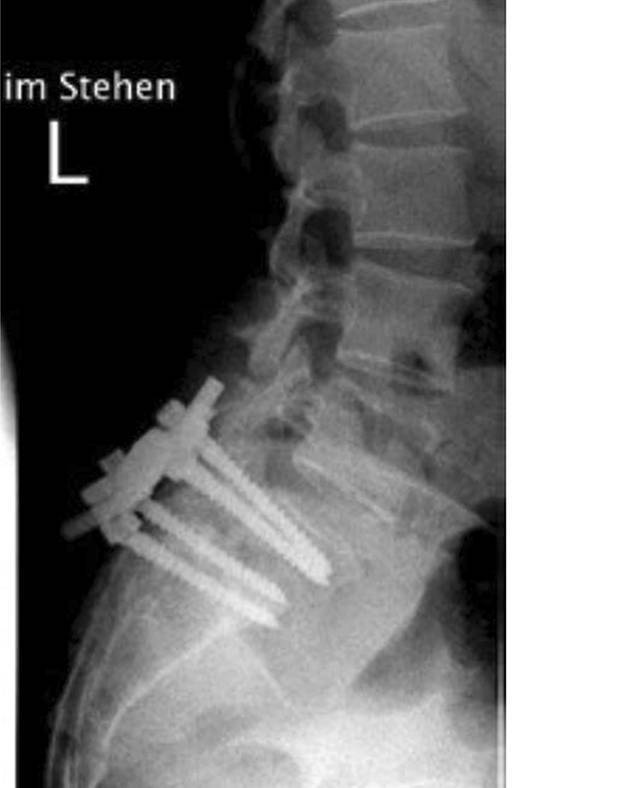 graphic file with name 132_2021_4140_Fig3_HTML.jpg