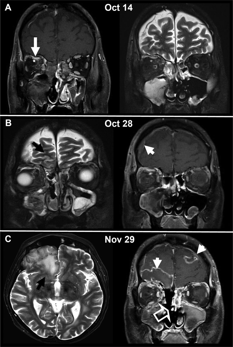 FIG 1