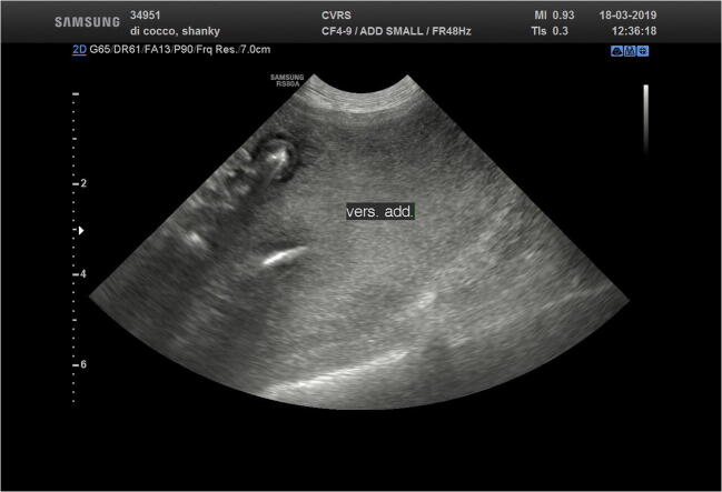 Fig 3