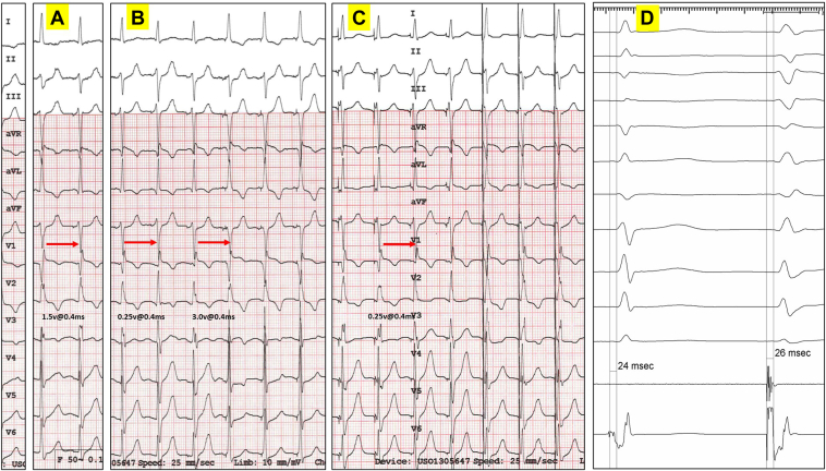 Figure 1