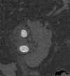 Figure 13a.