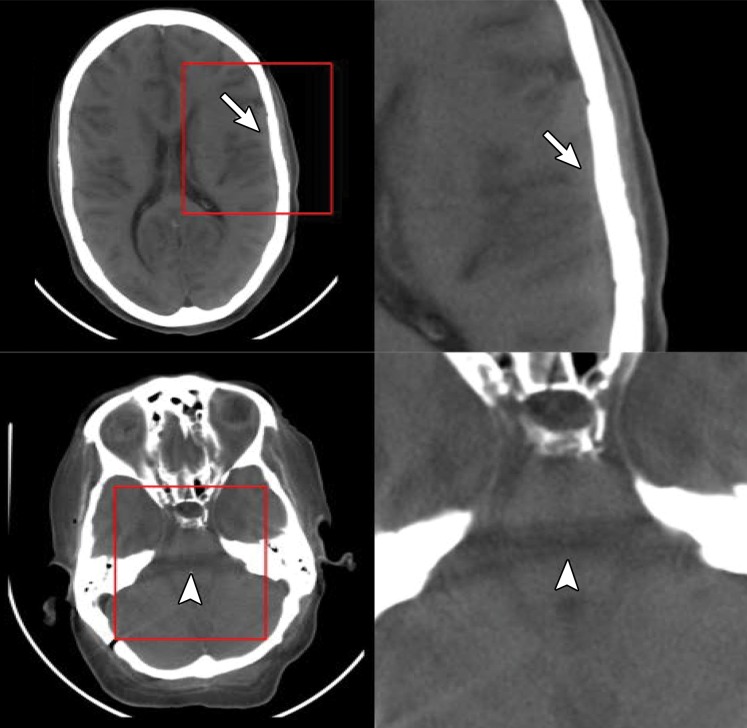 Figure 6a.