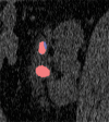 Figure 13b.