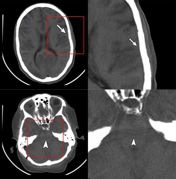 Figure 6c.