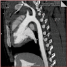 Figure 11a.