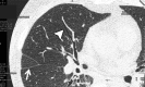 Figure 8a.