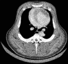 Figure 14b.