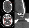 Figure 6b.