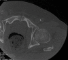 Figure 12a.