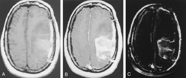 Fig 2.