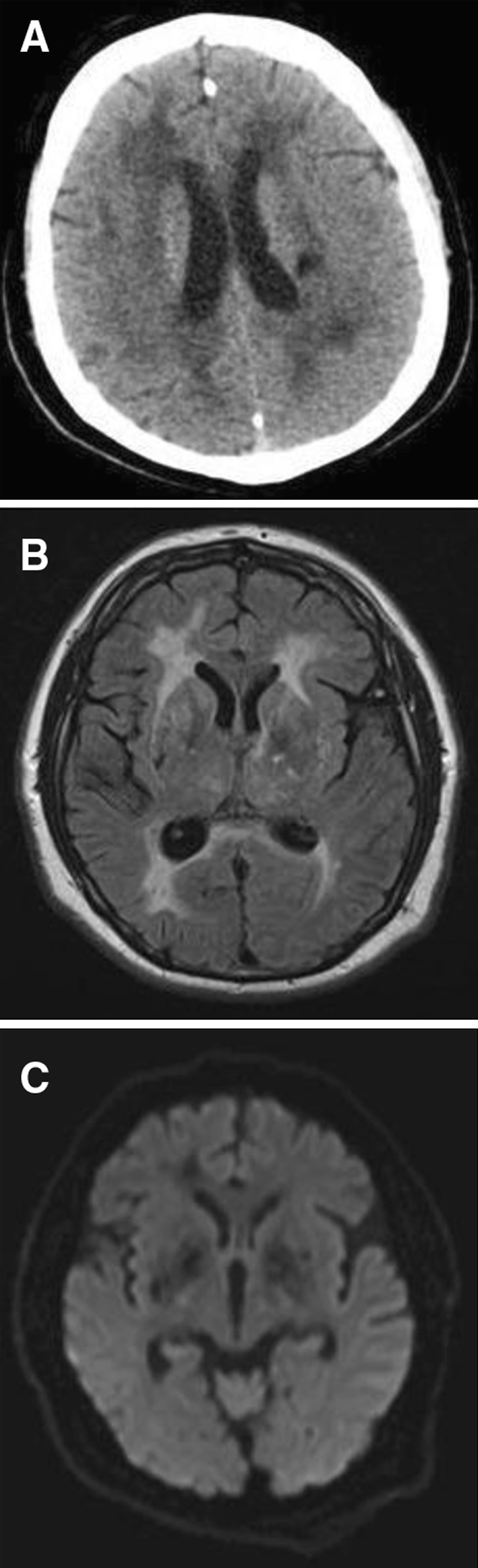 Fig. 1