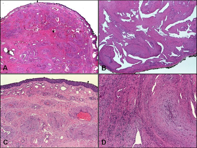 Fig. 1