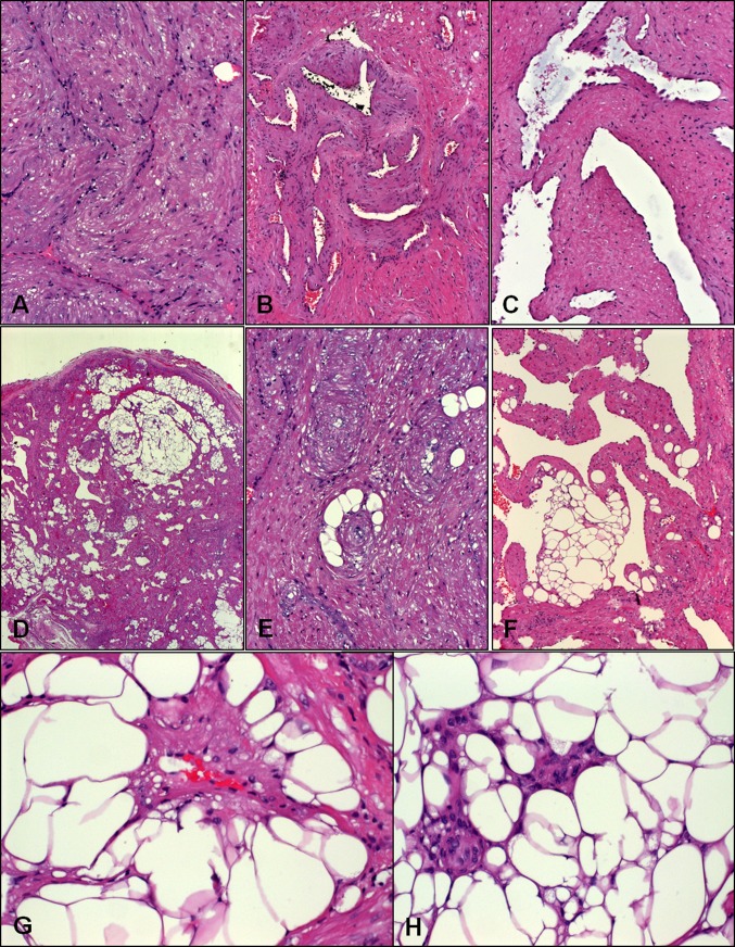 Fig. 2