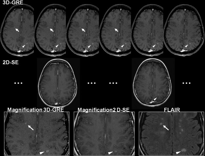 Fig 2.