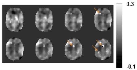 Fig. (4)