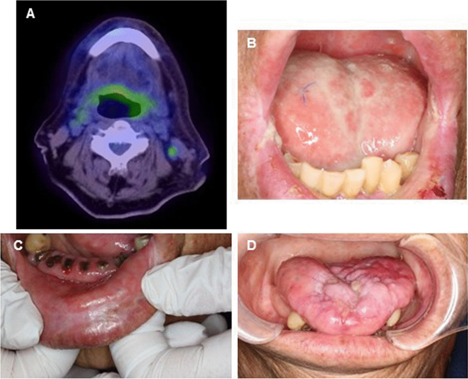 Fig. 4