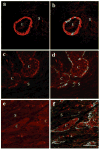 Fig. 11