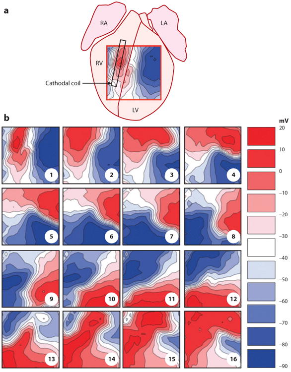 Figure 11