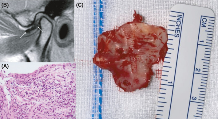 FIGURE 3