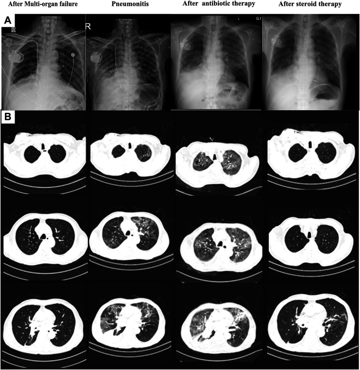 FIGURE 4