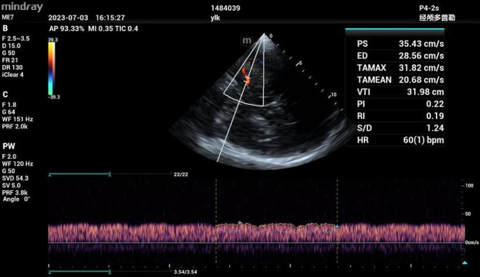 Fig. 4