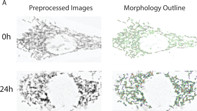 Figure 5—figure supplement 1.