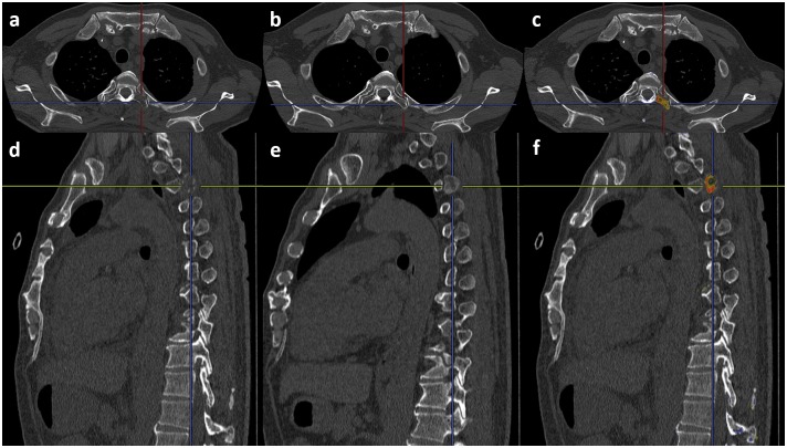 Fig 3