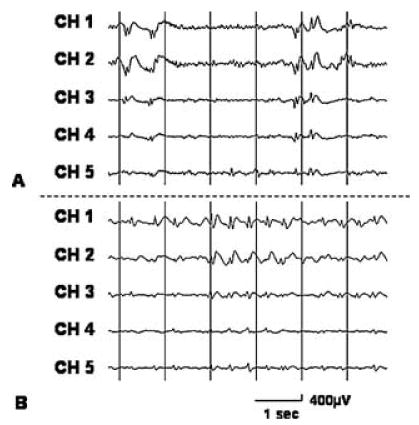 FIG. 3