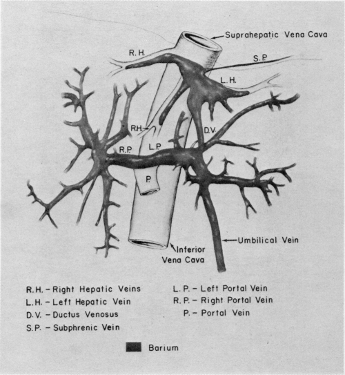 FIG. 1B