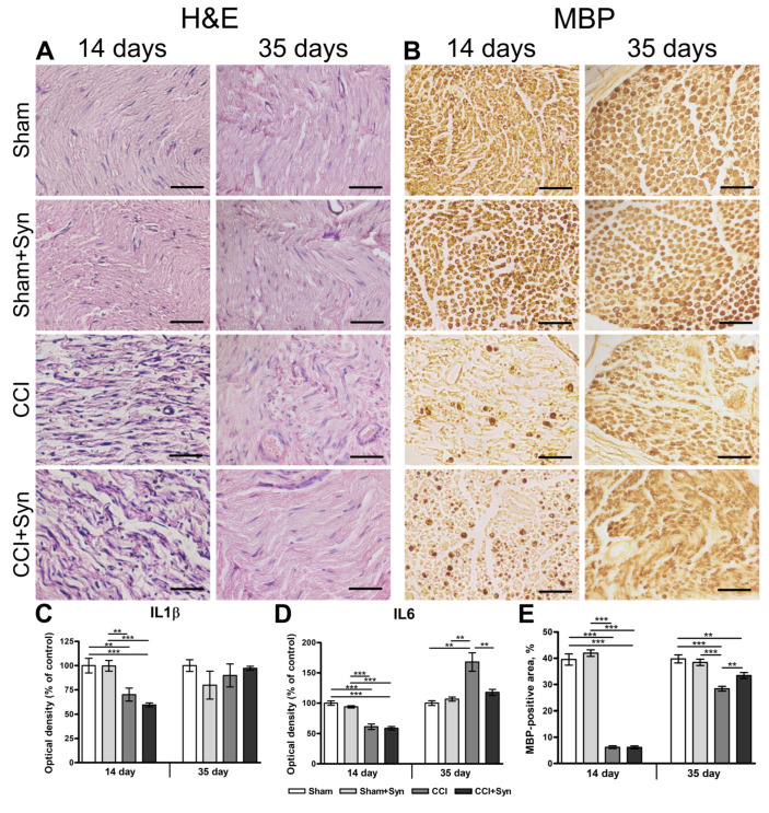 Anti-inflammatory Activity Of Synaptamide In The Peripheral Nervous 