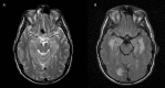 Fig 1.