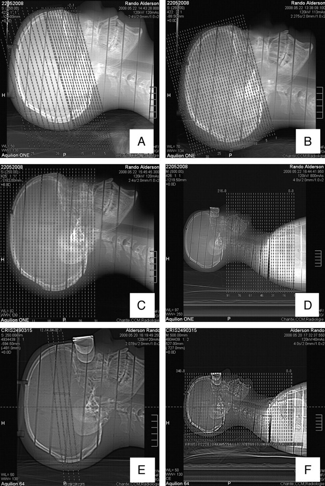 Fig 2.