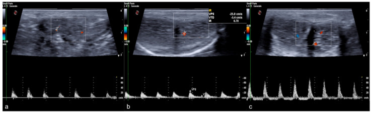 Figure 10