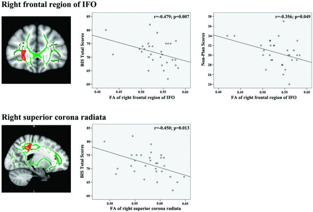 Fig 2.