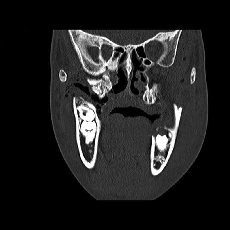 Fig. 11