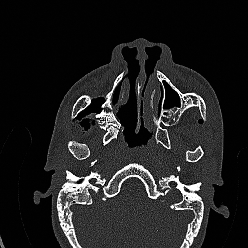 Fig. 10