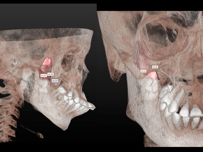 Fig. 7