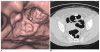 Fig. 5