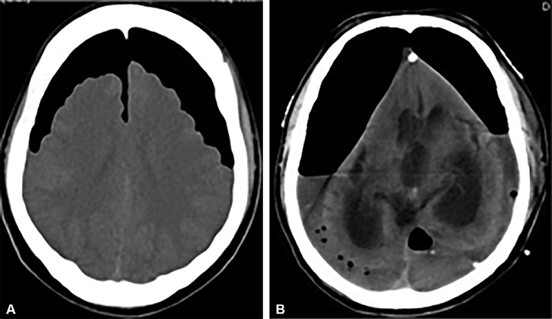 Fig. 5