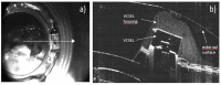 Fig 11