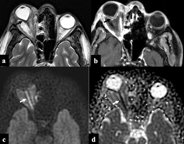 FIG 5: