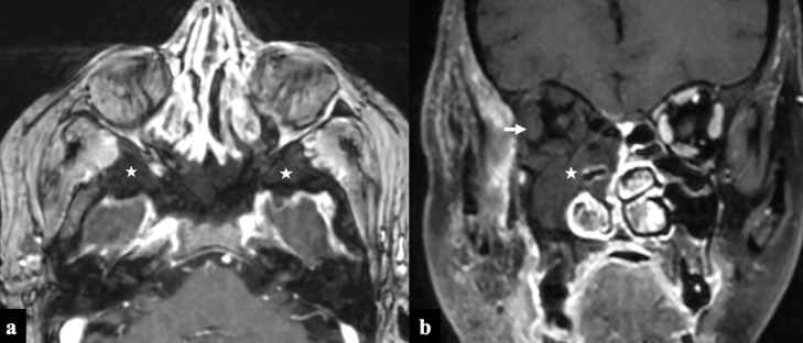 FIG 6: