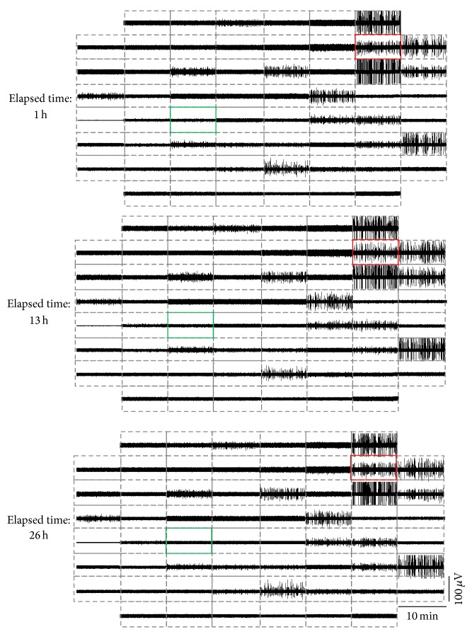 Figure 11