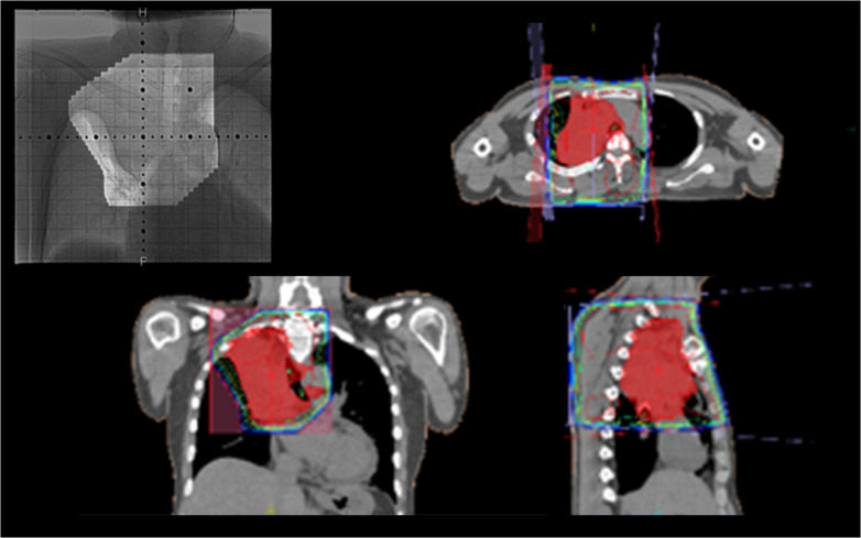 Fig. 2