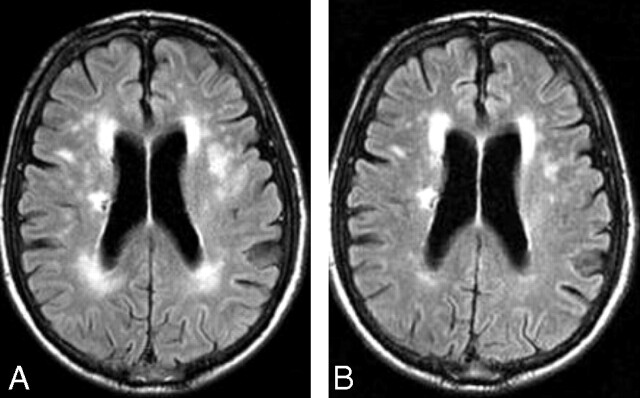 Fig 3.