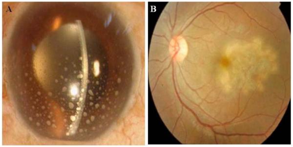 Fig. (4)