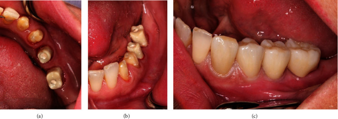 Figure 17