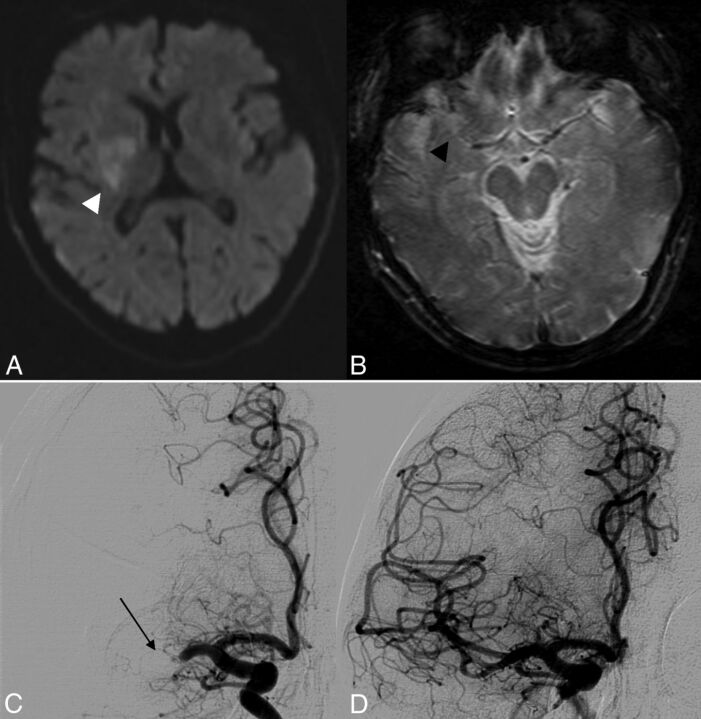 Fig 3.