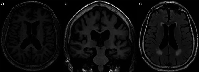 Fig. 2