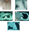 Fig. 1